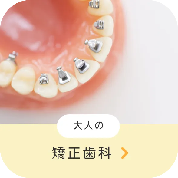 大人の矯正歯科