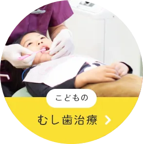 むし歯治療